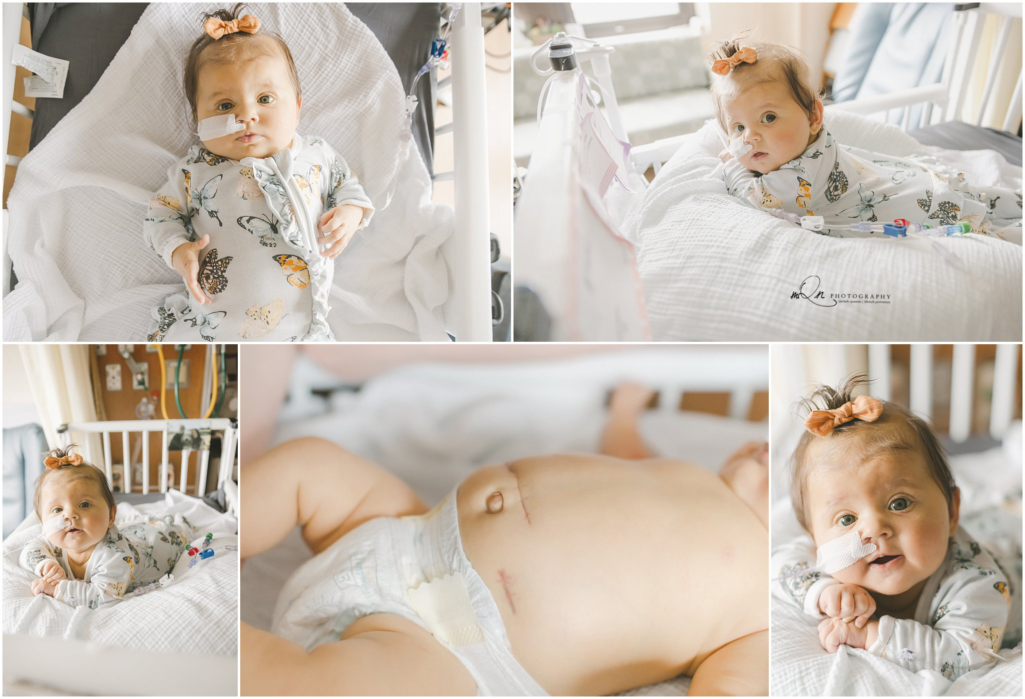 NICU baby on her belly