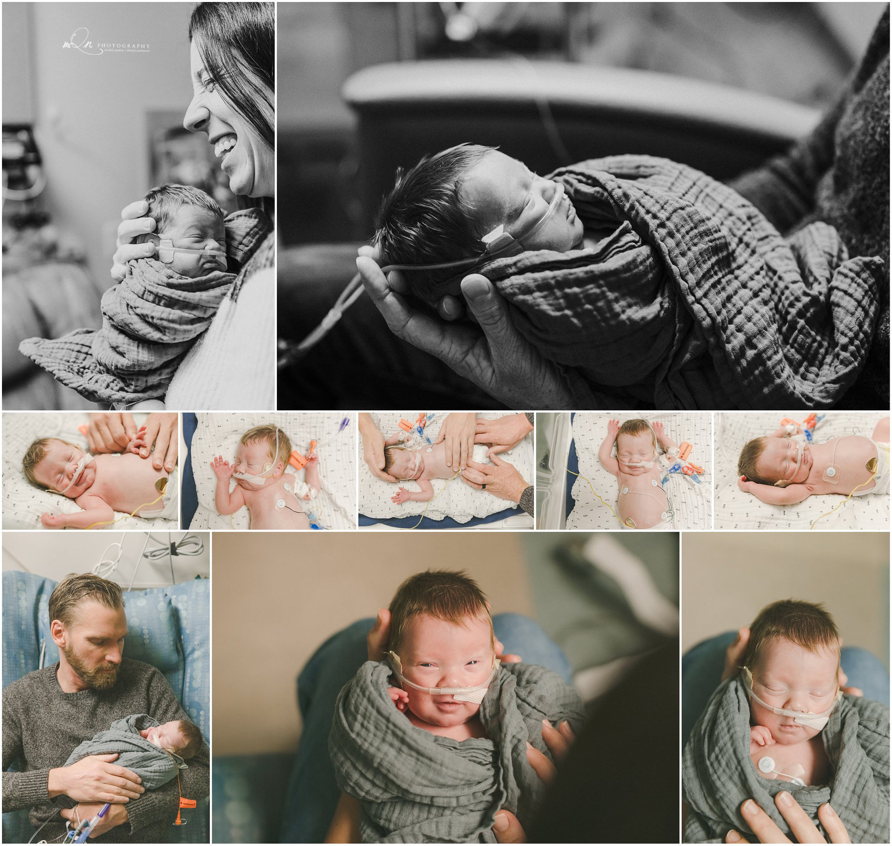 NICU baby at Children's Minneapolis